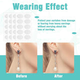 Vmun Premium Earlobe Support Patches (100 PCS)