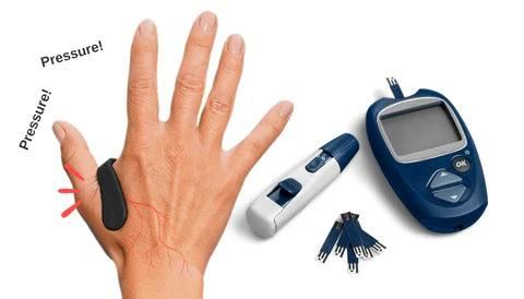 V Sugar Control LI4 Acupressure Point Clip